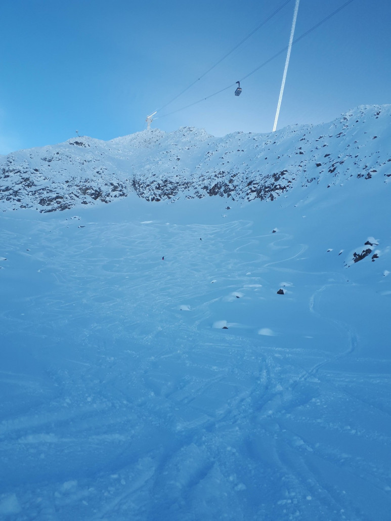 Es gibt unzählige Varianten in der breiten Schneeschüssel.