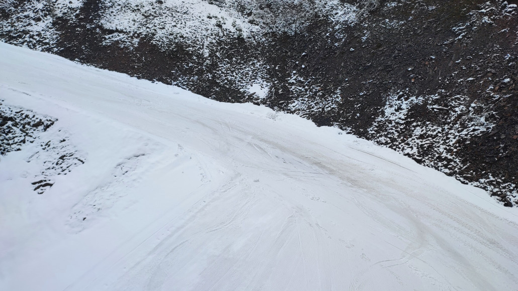 Gekratzt hat aber nichts, die Präparationslücken sind dann eher tückisch